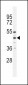 AGTR1 Antibody (Center)