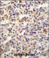 IGF2BP2 Antibody (C-term)