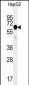 IGF2BP2 Antibody (C-term)