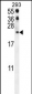 CCL21 Antibody (Center)
