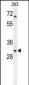 TNFRSF6B Antibody (N-term)