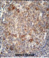 ABCC10 Antibody (Center)