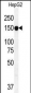 ABCC10 Antibody (Center)