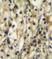 BCAT1 Antibody (Center)