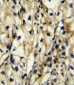 BCAT1 Antibody (Center)