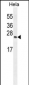 TIMP4 Antibody (Center)