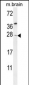 TIMP4 Antibody (Center)