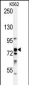 RPS6KA1 Antibody