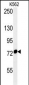 HSPA9 Antibody (Center)