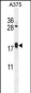 ARL8A Antibody (Center)