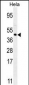 FOXL2 Antibody (N-term)