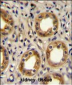 CXCR3 Antibody (Center)