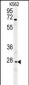 CXCR3 Antibody (Center)