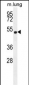 ELL Antibody (C-term)