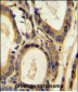 CCL4 Antibody (Center)