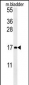 AP10172b-CCL4-Antibody-Center