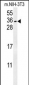 CITED2 Antibody (C-term)