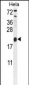 TRAPPC3 Antibody (N-term)