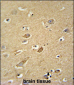ATP5H Antibody (Center)