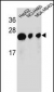 ATP5H Antibody (Center)