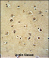 GABRG2 Antibody (Center)