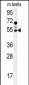 GABRG2 Antibody (Center)