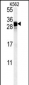 FGF7 Antibody (Center)