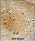 SPARCL1 Antibody (Center)