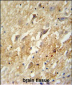 GABBR2 Antibody (C-term)