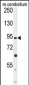 GABBR2 Antibody (C-term)