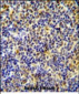 IKZF1 Antibody (C-term)