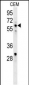 IKZF1 Antibody (C-term)