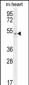 SLC10A4 Antibody (C-term)