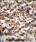 TFAM Antibody (C-term)