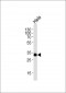 RPS6 (Ser240/244) Antibody