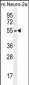 ZDHHC1 Antibody (N-term)