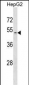 ZDHHC1 Antibody (N-term)