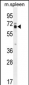 LMOD2 Antibody  (N-term)