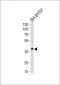 SERPINI1 Antibody (N-term)