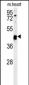 TINAGL1 Antibody (C-term)