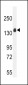 ITGA11 Antibody (N-term)