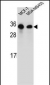 SAR1B Antibody (Center)