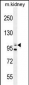 Nephrin (Y1210) antibody