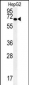 KEAP1 Antibody (C-term)