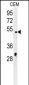 DCC1 Antibody (C-term)