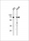 XRCC6 Antibody (Center)