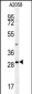 RIMS4 Antibody (N-term)