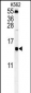 LSM4 Antibody (Center)