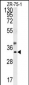 GCH1 Antibody (N-term)