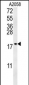 GM2A Antibody (N-term)